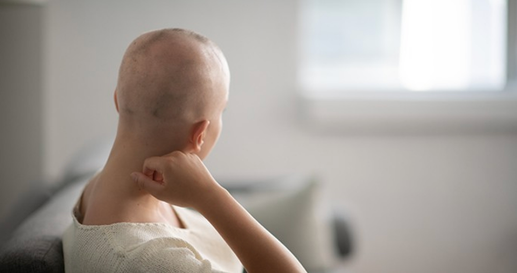 Hair loss from Chemo? Here's the best way to get a natural looking hair replacement